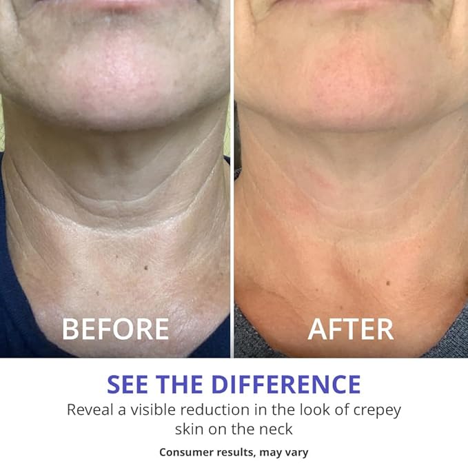 goPure Tighten and Lift Neck Cream - Clinically Tested - Pack of 2-BrightBean Baby