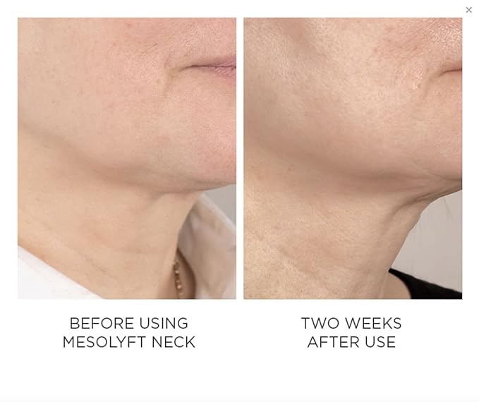 Power Combo Neck & eye Roller Brightening Face Serums for Anti-Aging Get Lip Pump's best Lip Plumper an Effectively Aging Skin Serum Multi-purpose, Eyes Neck & Décolleté Beauty Serum-BrightBean Baby