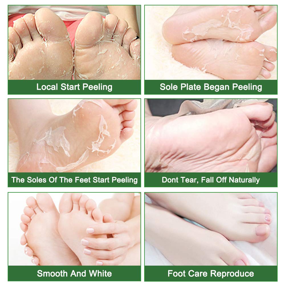 Foot Peeling Mask Moisturizing Socks 5Pairs, Foot Mask Remove Dead Skin, Rough Callus and Cracked Heels, Dry Skin Moisturizer for Soft and Smooth Baby Touch Feet (Tea Tree)-BrightBean Baby