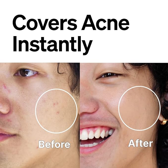 FRONTMAN Fade, Men's Acne Concealer With Salicylic Acid For Acne | For Blemishes & Dark Circles | Natural Coverage, Non-Greasy Formula, Oil-Free, Fragrance-Free | Perfect for All Skin Types | Men’s Concealer D2 Dark Shade-BrightBean Baby