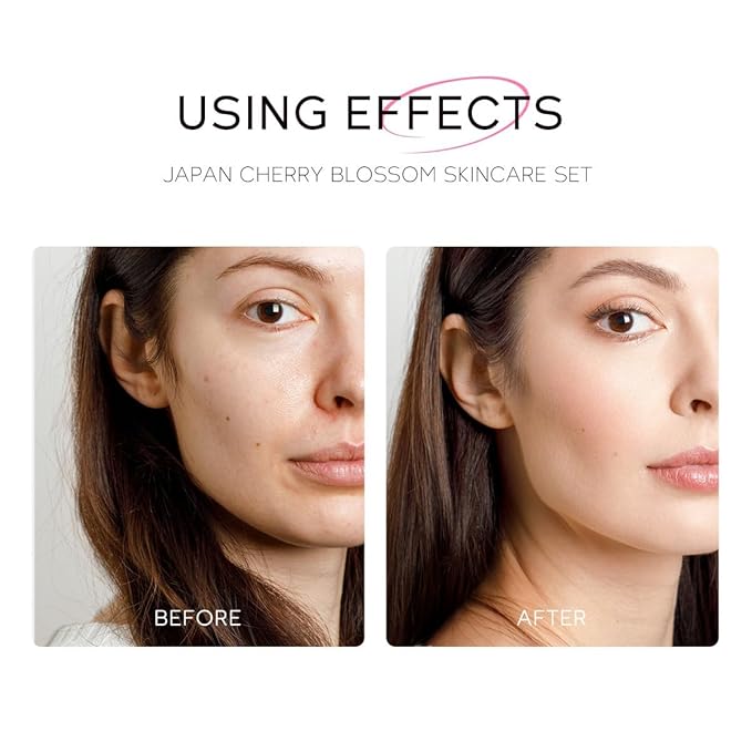 Greyghost Skin Care Set for Teenage Girls Women, 5 Pcs Cherry Blossom Skincare Set - Cleanser, Toner, Serum, Eye cream, Cream, Gentle Skin Cleaning & Care Gift Set, Travel Size Skin Care Set-BrightBean Baby