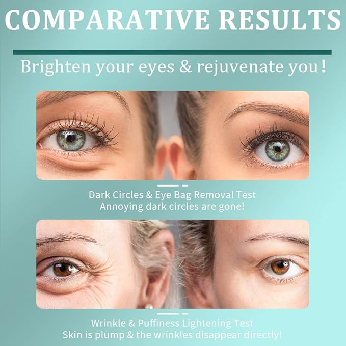 Under Eye Patches, Green Tea Under Collagen Eye Masks for Dark Circles Puffiness Eye Bag Wrinkles, Under Eye Treatment for Men Women, Anti-Aging Brightening Under Eye Gel Pads, 30 Pairs-BrightBean Baby