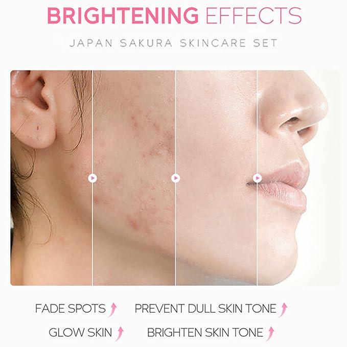 Skin Care Set - Sakura Skin Care Sets & Kits - Women Gift Sets with Cleanser,Serum,Eye Cream,essence Cream - Beauty Products For Women - Skin Care Routine Travel Kit (SetB)-BrightBean Baby