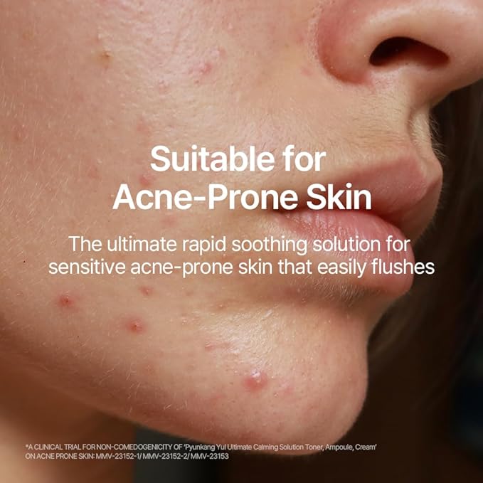 Pyunkang Yul Ultimate Line Skincare Set, Mother's day gift for mom, Calming Solution Toner, Ampoule & Cream, Traditional Korean-Style Packaging, Zero-Irritation (3-item set)-BrightBean Baby