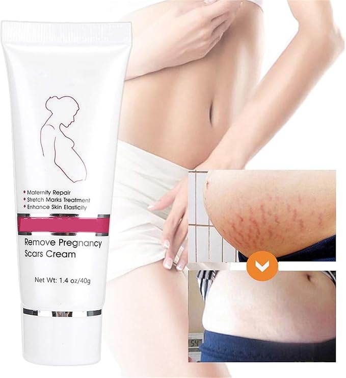 RtopR Stretch Marks and Scar Cream,Crema para Estrias De Embarazo,Stretch Marks Postpartum Repairing Cream Wrinkles Diluting Removal Cream Crema De Cacao para Cicatrices-BrightBean Baby