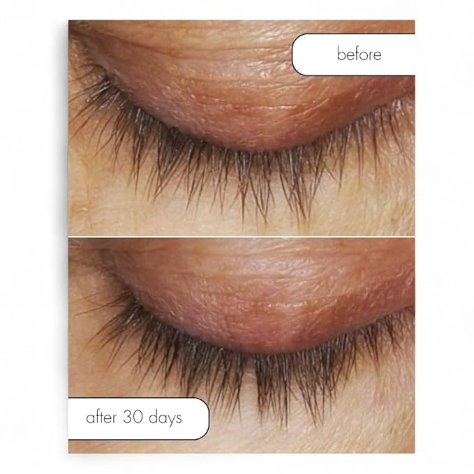 Serious Skincare Lash Bath & Conditioner - Double Action Eye Makeup Remover - Oil Free - Enhancing Peptides Promotes Eyelash Growth - Clover Flower - Effortlessly Removes Waterproof Mascara - 4 oz.-BrightBean Baby