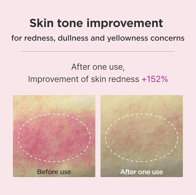 ISOI Blemish Care Up Serum Gift Set, Korean Skin Care for Hydration & Radiance – Full Size or 5-Step Travel Kit Options (5-Step Special Kit (1.77 fl.oz))-BrightBean Baby