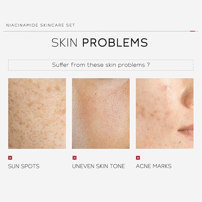 skin care set - skincare set for women - facial skin care sets & kits - gift set skincare - skin care sets for teens- skin care sets for men (ceramide)-BrightBean Baby