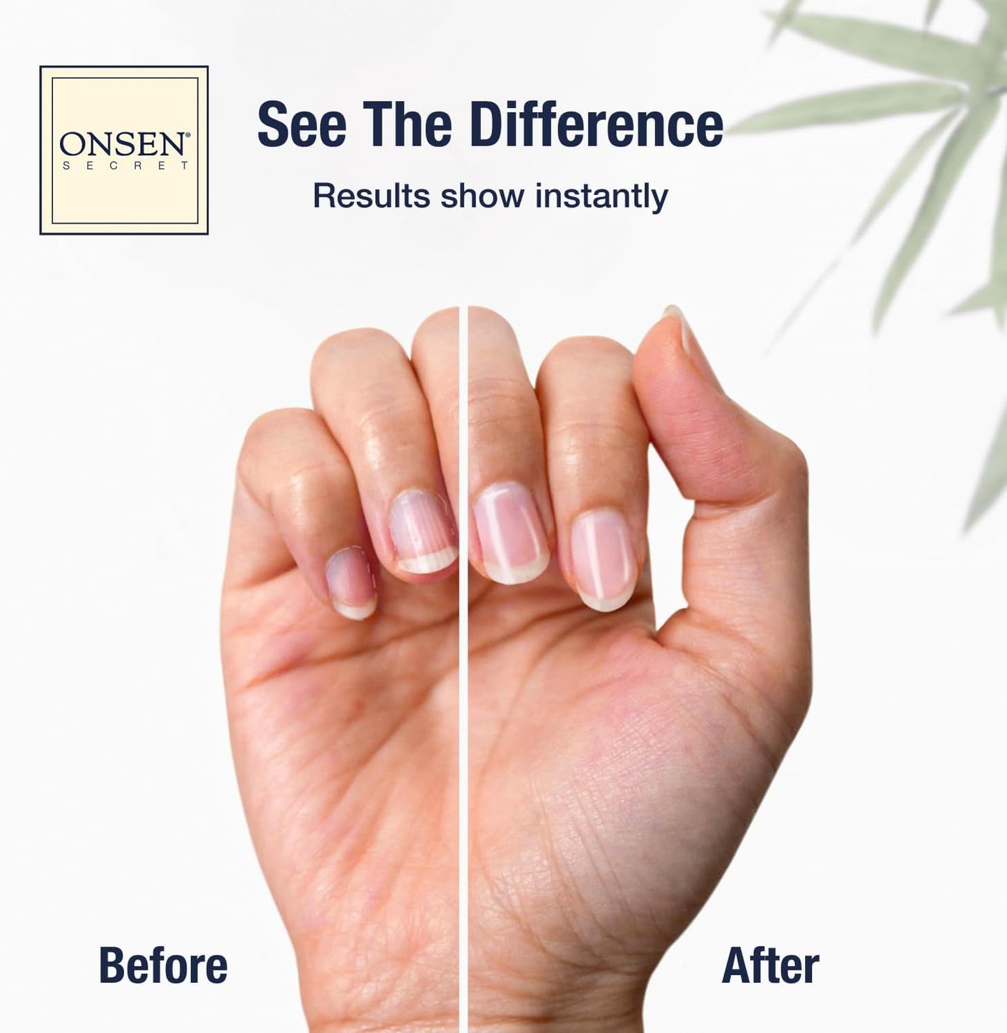 Onsen Secret Ultimate Nail Reboot Kit - Professional Nail File and Buffer, 3-Way Block w/Replacement Pads, Nail Strengthening Cuticle Cream, Reboot Oil & Anti Aging Hand Lotion-BrightBean Baby