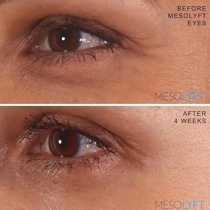 Power Combo Neck & eye Roller Brightening Face Serums for Anti-Aging Get Lip Pump's best Lip Plumper an Effectively Aging Skin Serum Multi-purpose, Eyes Neck & Décolleté Beauty Serum-BrightBean Baby