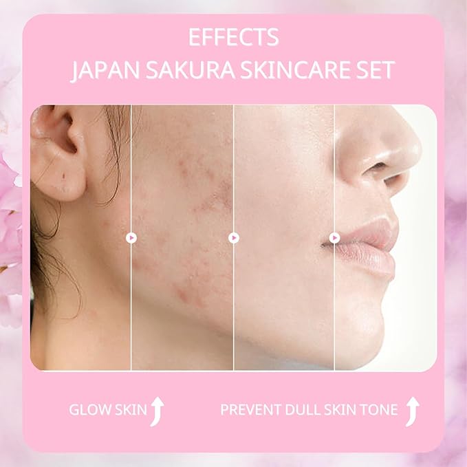 Sakura Skin Care Set, Women Gift Sets, Skin Care Kit with Cleanser, Toner, Serum, Eye Cream, Face Cream, Skin Care Routine Kit for Women, Even Skin Tone, Tighten & Firm Skin-BrightBean Baby