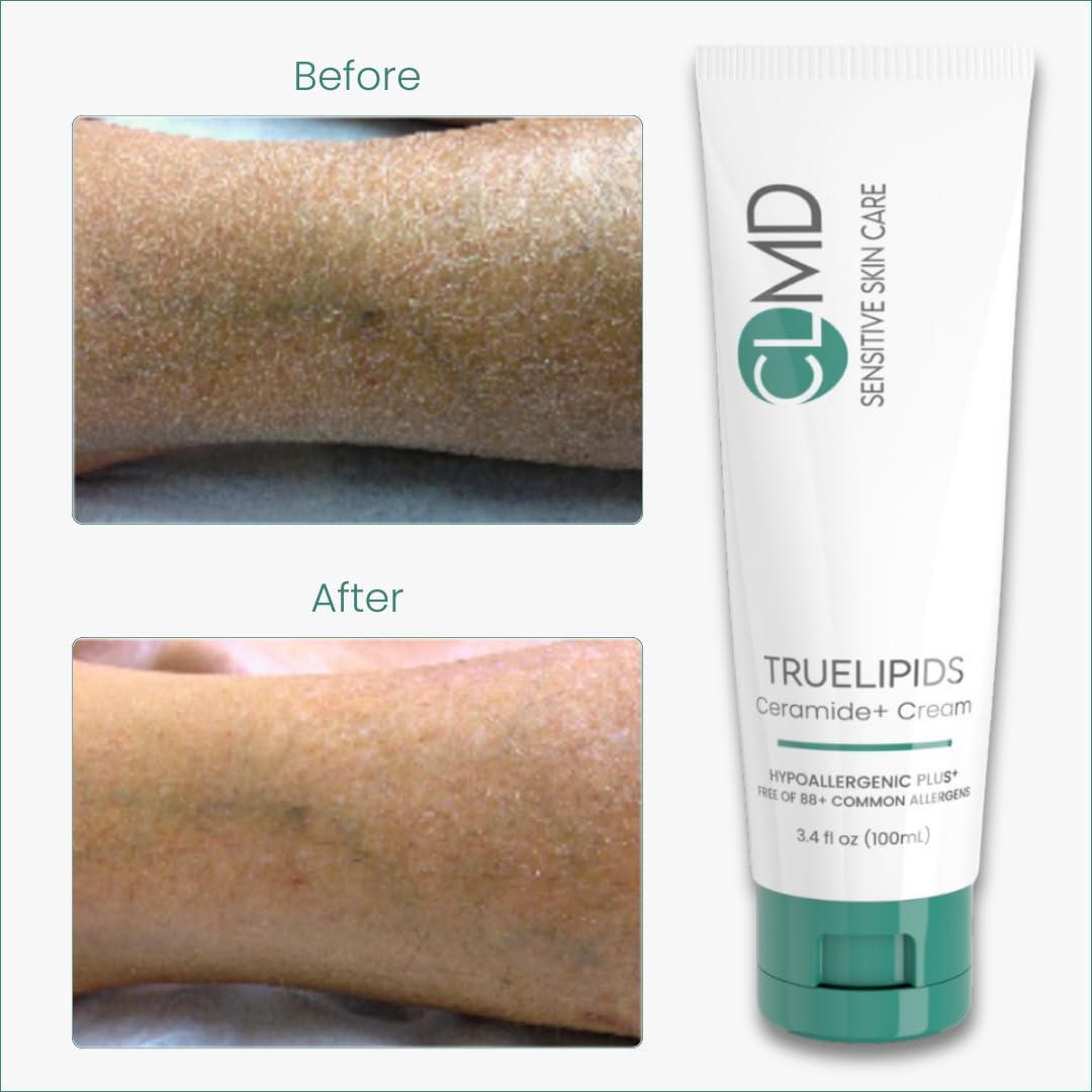 CLMD TrueLipids Ceramide+ Cream – Deep Moisturizing Barrier Support for Sensitive Skin – Hydrates and Soothes – Hypoallergenic, Nourishing, and Dermatologist-Tested – 3.4 fl oz-BrightBean Baby