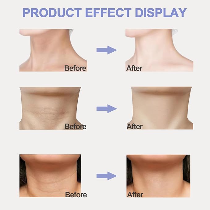 Neck Firming Cream, Neck Tightening Cream, Tighten and Lift Neck Cream, Neck Creams for Tightening and Firming Sagging Skin, Help Reduce Fine Lines & Wrinkles-BrightBean Baby