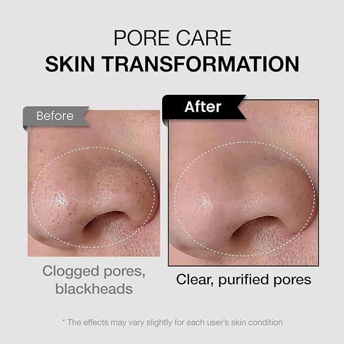 coxir TXA MUCIN ALL-IN-1 PORE MASK –Gelato Texture Wash-Off treatment | Ampoule Mask-to-Foam | Charcoal+ Snail+TXA | Blackhead Remover |Daily Pore Detox for Oily & Sensitive Skin|4.05fl.oz-BrightBean Baby