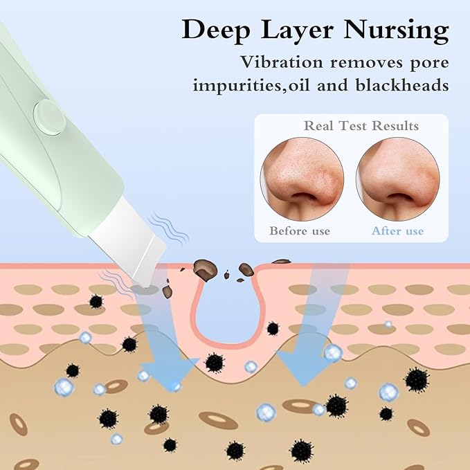 Skin Scrubber Face Spatula Skin Spatula Pore Cleaner Blackhead Remover Tools for Facial Deep Cleansing Skin Care Tool for Men and Women (Green)-BrightBean Baby