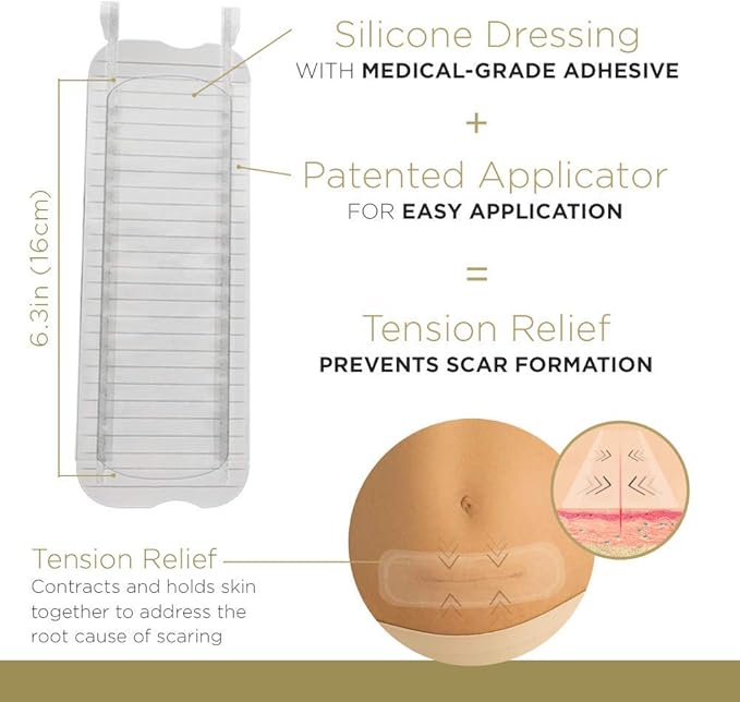 Embrace Active Scar Defense for New Scars, FDA-Cleared Medical-Grade Silicone Scar Sheets for Hypertrophic & Keloid Scar Treatment, 6.3 Inch, Extra-Large, 30-Day Supply-BrightBean Baby