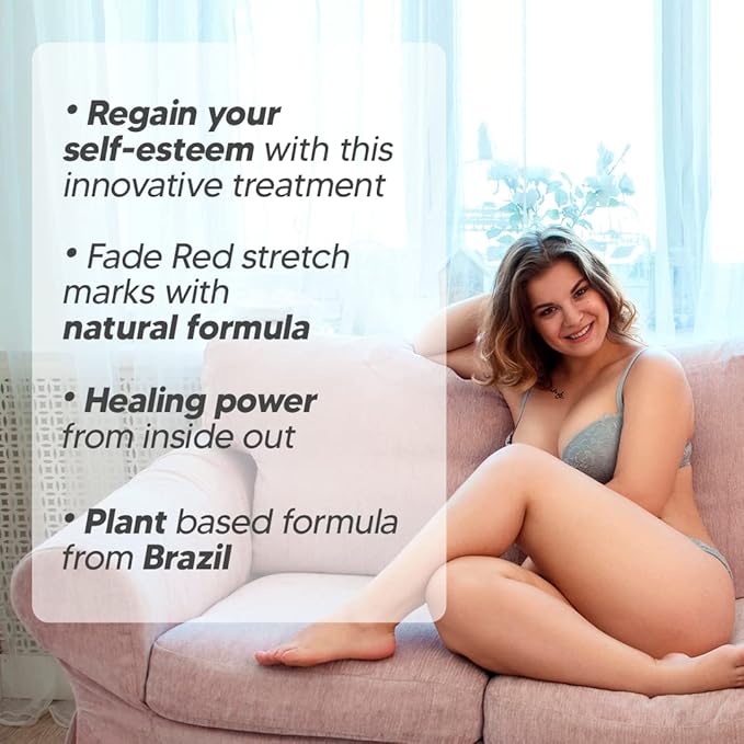 Cicatrissim Red For Removal of Red and Purple Stretch Marks - Innovative Formula With Pure and Powerful Natural Ingredients From Brazilian Flora - For All Skin Types.-BrightBean Baby