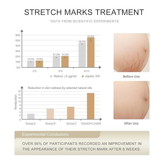 Stretch Mark Oil（110ml）, body oil for Pregnancy,belly oil, belly abdominal Serum Skin Care,Moisturizing Dry Skin, Tender & Softening，True Belly Serum 3.7OZ-BrightBean Baby