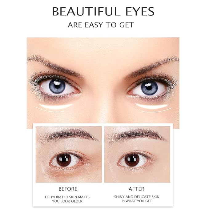 VENZEN Gold Moisturizing Eye Cream Anti Aging Anti Wrinkle Shade Dark Circles Shine Serum Glycerin Delicate Hyaluronic Acid 15g-BrightBean Baby