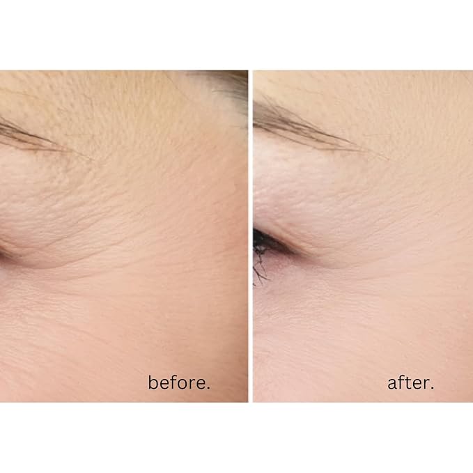 AWARD-WINNING Anti-Age Eye Cream - 5X MORE EFFECTIVE. With 20% Vitamin C & Hyaluronic Acid. Blast away dark circles, eye bags and puffiness - Reduce wrinkles and crow’s feet. Highest strength. 15ml-BrightBean Baby