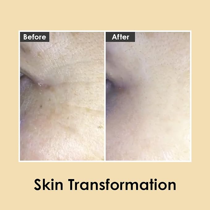 Medi-Peel Peptide9 Hyaluronic Volumy Eye Cream, Anti-Aging, Brightening, Reduces Wrinkles, Under Eye Bags, Dark Circles & Puffiness Care, Hyaluronic Acids, Enhance Elasticity, Korean Skin Care-BrightBean Baby