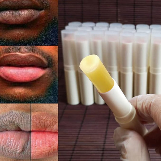 2PCS Handmade Plant lip balm Pink Lips Serum Brighten Dark Lips Bleaching Essence Lip Balm Repair Fine Lines Brighten Moisture Exfoliator Lip Care (Yellow)-BrightBean Baby