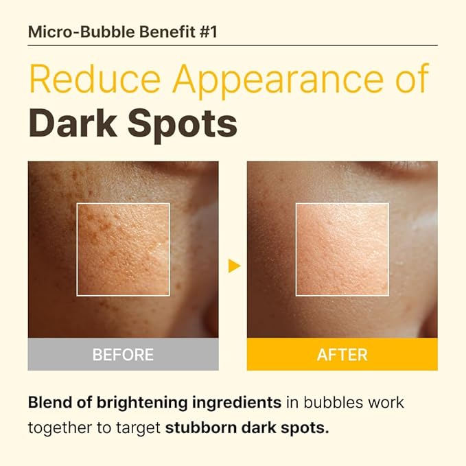 MENOKIN 30 Seconds Quick Bubble Mask [BRIGHT] - [Vitamin C] [Glutathione & Niacinamide] in Micro-bubbles for Dark Spots, Uneven Skin Tone, Korean Skin Care Essential, 70 Uses, 3.21 fl.oz-BrightBean Baby