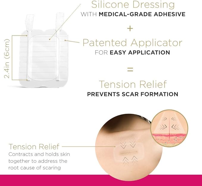 Embrace Active Scar Defense for New Scars, FDA-Cleared Silicone Scar Sheets, 2.4 Inch, Medium, 60 Day Supply (Recommended Treatment)-BrightBean Baby