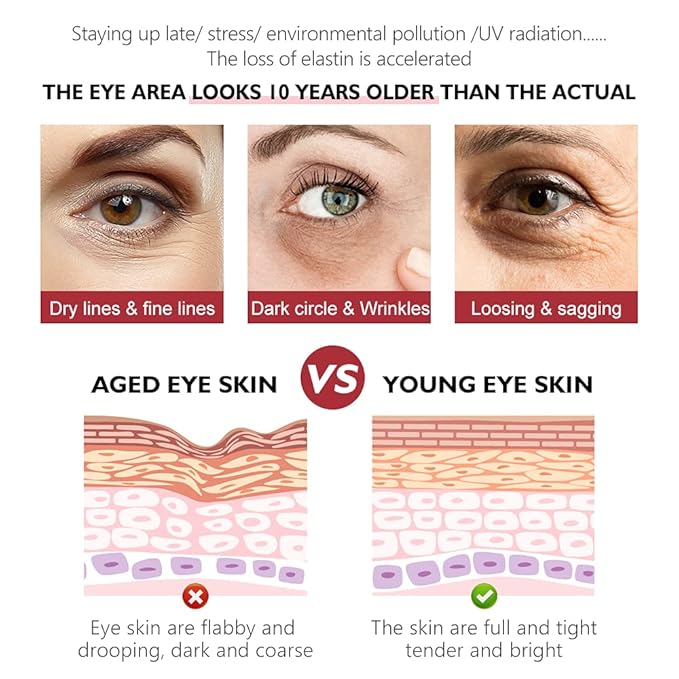 Retinol Eye Cream, Anti-Aging with Vitamin C & Ceramide for Dark Circles, Wrinkles & Fine Lines, Crow’s Feet, 0.7 fl.oz-BrightBean Baby