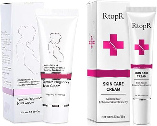 RtopR Stretch Marks and Scar Cream,Crema para Estrias De Embarazo,Stretch Marks Postpartum Repairing Cream Wrinkles Diluting Removal Cream Crema De Cacao para Cicatrices-BrightBean Baby