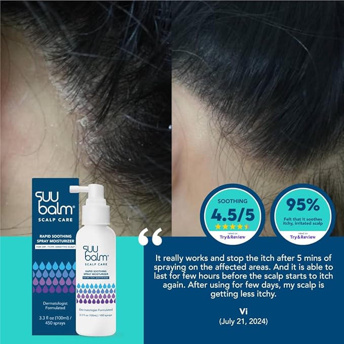 Rapid Itch Relief Anti-Dandruff Scalp Spray Moisturizer, Dry Scalp Spray, Cooling Itchy Scalp Treatment for Flaky Sensitive & Psoriasis, Derm-Formulated. Menthol & 5 Ceramides, 1.35 fl oz-BrightBean Baby