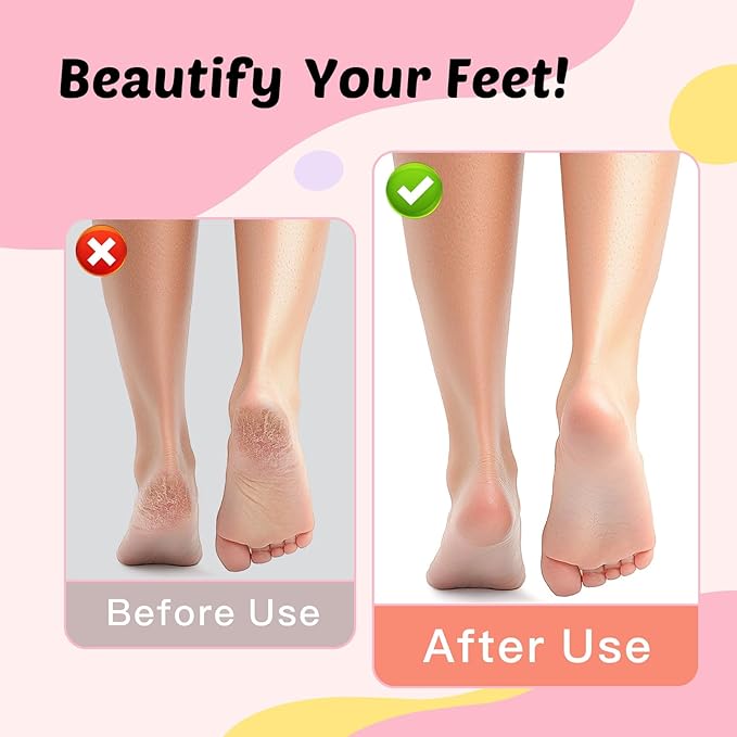 Electric Foot Callus Remover & Nail File - Electric Callus Remover for Feet, 9 Adjustable Speeds, 1800mAh Rechargeable, Portable Aluminum Body w/Type-C Charging for Home & Travel (Black)-BrightBean Baby