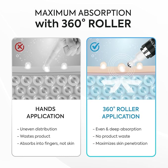 Dark Spot Remover for Face: Remove Sun & Age Spot Corrector – Melasma & Hyperpigmentation Brightening Serum for Body(Hand Leg Arm) – Brown Skin and Freckles Removal Treatment with Roller 15ml-BrightBean Baby