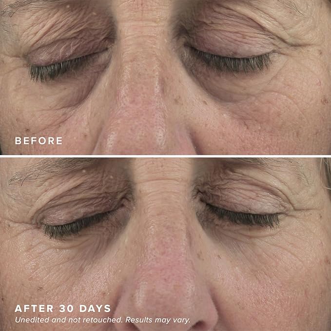 DRMTLGY Brightening Eye Masks (30 Pairs) - Caffeine Eye Masks for Dark Circles and Puffiness with Hyaluronic Acid, Eye Patches for Puffy Eyes - 2 pack-BrightBean Baby