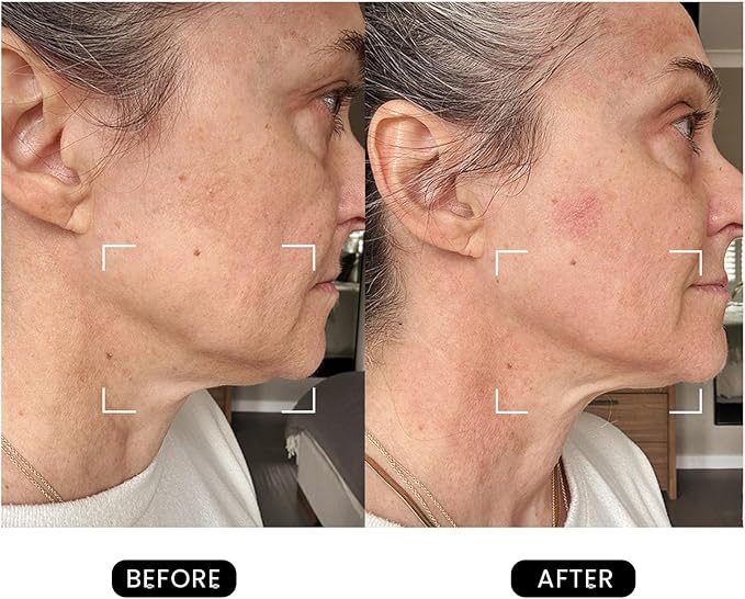 Revive Skincare for Anti-Aging, Glow Like Never Before,Multifunctional Beauty Device, Facial Massager for Home use-BrightBean Baby