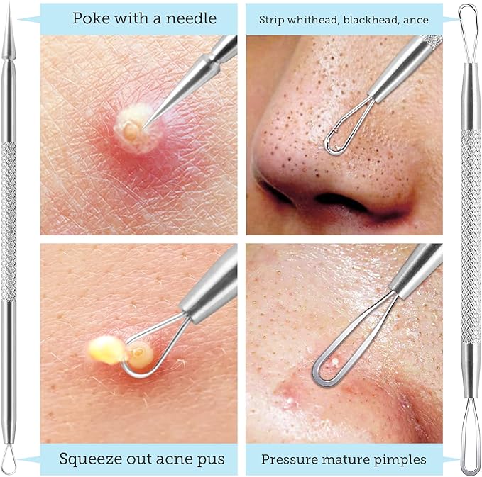 LitBear Pore Prep Tool, Blackhead Remover Pimple Popper Tool Kit, Stainless Steel Blackhead Extractions Tool for Acne, Whitehead Popping, Blemish, Comedone, Black-BrightBean Baby