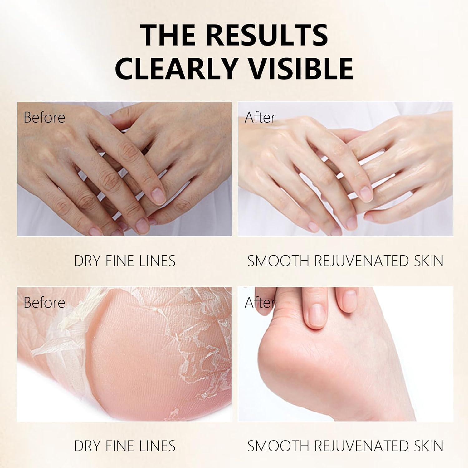 Hydrating Hand Foot Masks Set for Women Men,3 Pack Glove Mask for Dry Hand & 3 Pack Socks Mask for Dry Cracked Feet（Milk）-BrightBean Baby