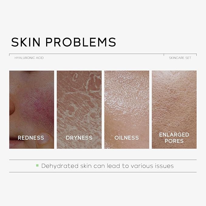 Hyaluronic Acid Skin Care Set, Hydration Kit for Women Teen Girls, Low pH Cleanser, Moisturizer, Serum, Eye Cream, Anti Aging, Firming, Travel Size Facial Care Gift Set for Dry Sensitive Skin-BrightBean Baby