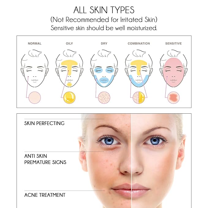 Pure Vitamin C Facial Serum with Salicylic Acid and Glycolic Acid, Anti-Wrinkle, Anti-Acne and Anti-Blackhead, Dark Spot Correcting, 7,5% AHA, Sebum Balance, ¾ oz-BrightBean Baby