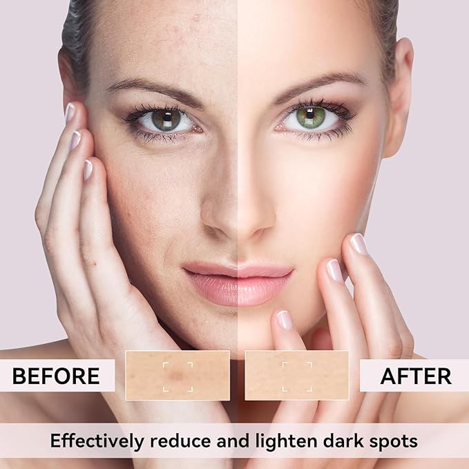 Dark Spot Remover for Face, Dark Spot Corrector for Age Spot Sun Spot Brown Spot Melasma Uneven Skin Tone, with Vitamin C and Hyaluronic Acid for Women and Men, 1.7 FL OZ-BrightBean Baby