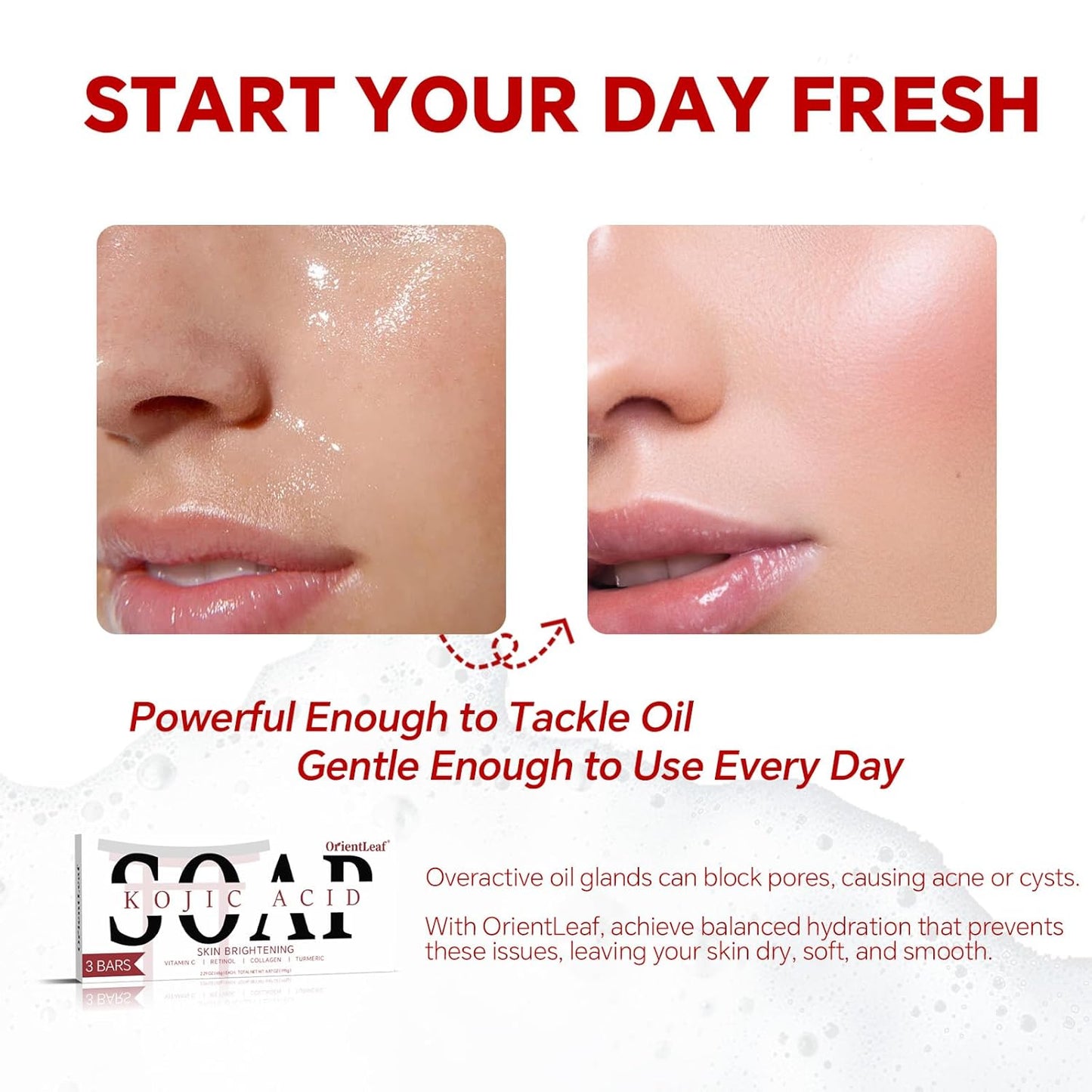 Kojic Acid Soap, Turmeric Soap Bar for Dark Spots, Fresh Citurs Scent, Gentle for Face and Body Wash with Vitamin C, Shea Butter, Retinol, Olive Oil, Collagen (3 PACK)-BrightBean Baby