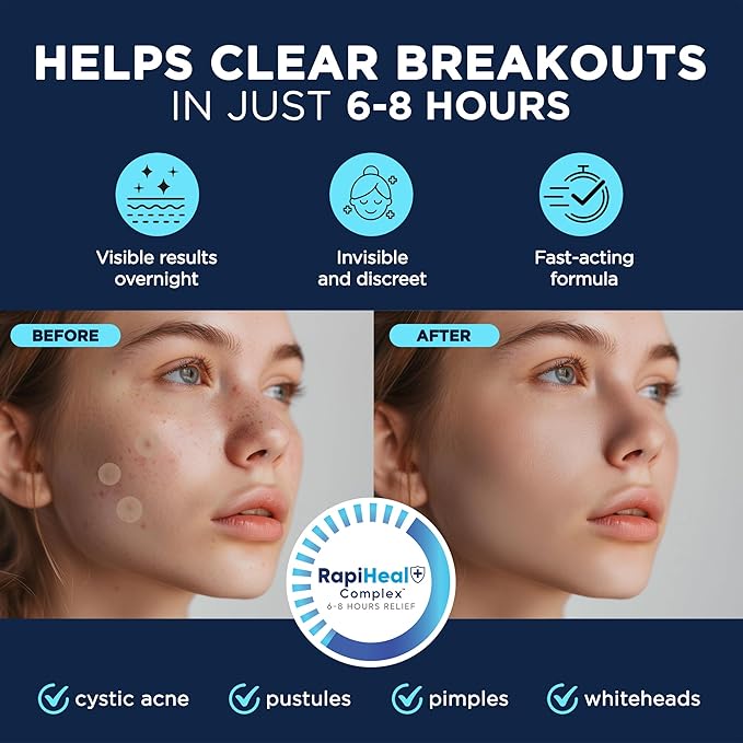 Pimple Patches for Face - 134 Count Hydrocolloid Acne Patches - Zit, Blemish, Cystic Acne Dots & Dark Spot Treatment - Invisible Clear Pimple Patch Stickers for Forehead, Chin, Nose, 3 Sizes (S, M, L)-BrightBean Baby