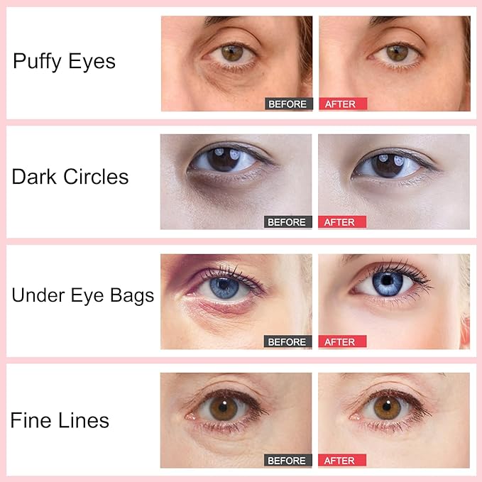 Retinol Eye Stick, Retinol Eye Cream for Dark Circles and Puffiness, Under Eye Cream Anti Aging, Eye Cream for Puffiness and Bags under Eyes, Brightening Eye Balm Reduces Fine Lines and Dark Circles-BrightBean Baby