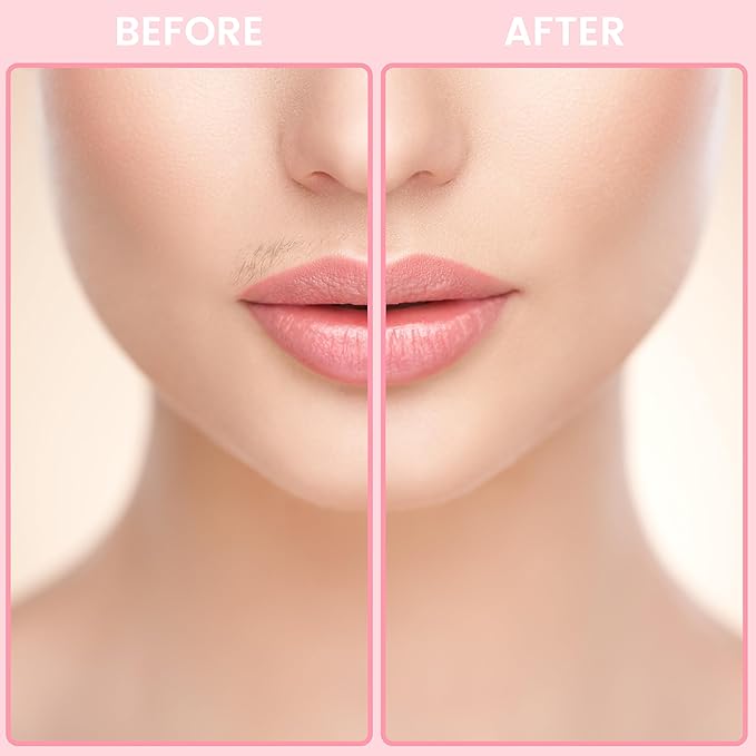 SweetLF Portable Electric Shaver for Women, IPX7 Waterproof, Painless, Rechargeable, Wet & Dry Shaving, Face & Chin & Upper Lip, Black-BrightBean Baby