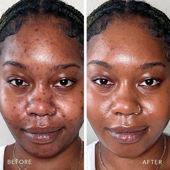 Doll 10 TCE Liquid Filter - Covers, Blurs, and Brightens (Fair/Light)-BrightBean Baby