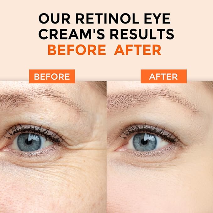 Retinol Eye Cream for Dark Circles and Puffiness, Anti Aging Under Eye Cream with Hyaluronic Acid, Retinol & Collagen to Fight Fine Lines, Wrinkles & Dark Spots-BrightBean Baby