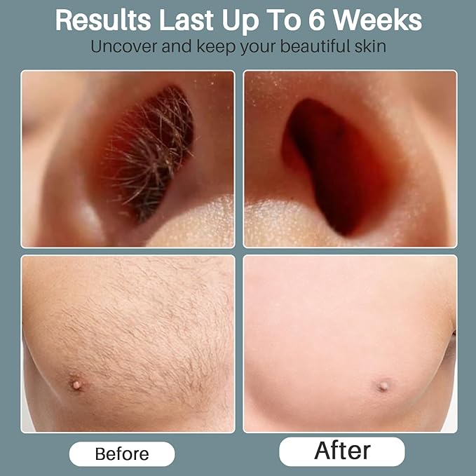 BLITZWAX Back and Nose Waxing Kit for Men, Hard Wax Warmer for Brazilian, Body and Face, At Home Hair Removal Kit, Beginner Friendly, Quick Heating, 93 Accessories, Blue Spruce-BrightBean Baby