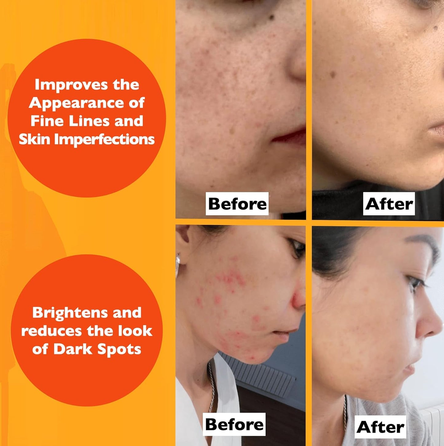 Vitamin C Serum For Face – Anti-Aging Facial Serum with Vitamin C, Hyaluronic Acid, Niacinamide, B5 & Vit E. Brightening Facial Essence for Dark Spots, Fine Lines, Wrinkles & Glowing Skin, 2 Fl Oz-BrightBean Baby