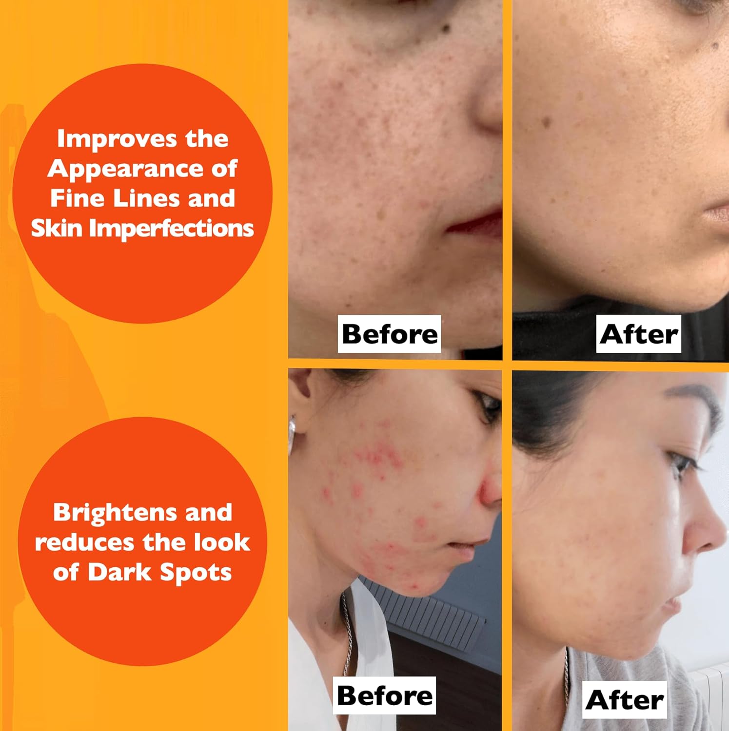 Vitamin C Serum For Face – Anti-Aging Facial Serum with Vitamin C, Hyaluronic Acid, Niacinamide, B5 & Vit E. Brightening Facial Essence for Dark Spots, Fine Lines, Wrinkles & Glowing Skin, 2 Fl Oz-BrightBean Baby