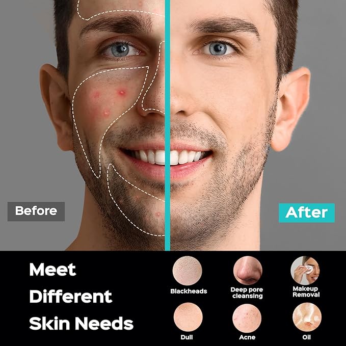 COSLUS Facial Cleansing Brush Face Scrubber : Portable Silicone Waterproof Rechargeable Face Wash Brush, 5 Cleansing Modes, Electric Deep Cleaning for Men & Women, Removing Blackhead, Exfoliating-BrightBean Baby